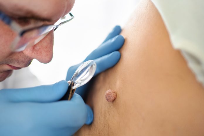 ¿Tienes picazón en la piel? ¡Cuidado! Puede ser cáncer. ¿Tienes picazón en la piel? ¡Cuidado! Puede ser cáncer.
