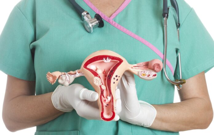Cáncer de cuello uterino y HPV es una enfermedad prevenible que requiere educación y prevención