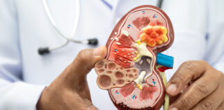 Chequeos médicos y prevención son claves para proteger la salud renal