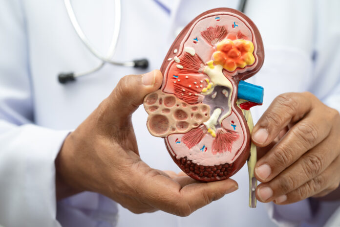 Chequeos médicos y prevención son claves para proteger la salud renal