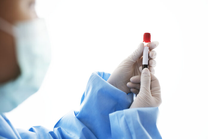 Doctor holding a blood test tube Claves para mejorar la calidad de vida en personas con hemofilia