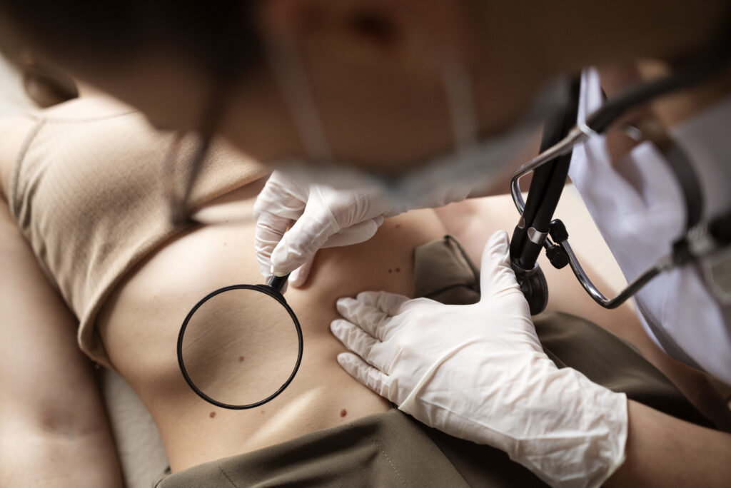 ¿Quieres saber cuál es el cáncer de piel más agresivo que puede cambiar su pronóstico con detección temprana?