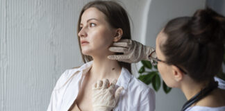 ¿Quieres saber cuál es el cáncer de piel más agresivo que puede cambiar su pronóstico con detección temprana?