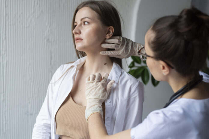 ¿Quieres saber cuál es el cáncer de piel más agresivo que puede cambiar su pronóstico con detección temprana?