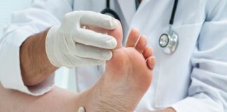 Pie diabético puede comenzar con una lesión que pasa desapercibida