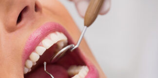 Odontología preventiva busca cambiar la experiencia de ir al dentista