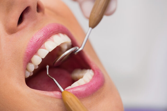 Close up of dentist examining female patient teeth Odontología preventiva busca cambiar la experiencia de ir al dentista